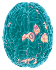 Colored brain scan showing neural activity.